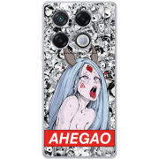Чехол BoxFace Infinix GT 20 Pro Ahegao