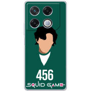 Чехол BoxFace Infinix GT 20 Pro siquid game 456