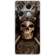 Чехол BoxFace Infinix GT 20 Pro 