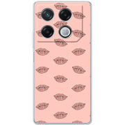 Чехол BoxFace Infinix GT 20 Pro 