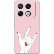 Чехол BoxFace Infinix GT 20 Pro 