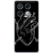 Чехол BoxFace Infinix GT 20 Pro 