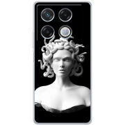 Чехол BoxFace Infinix GT 20 Pro 