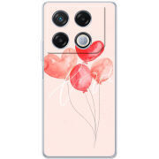 Чехол BoxFace Infinix GT 20 Pro 