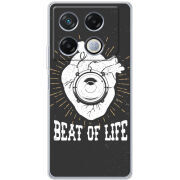 Чехол BoxFace Infinix GT 20 Pro 