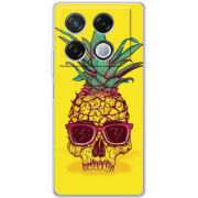 Чехол BoxFace Infinix GT 20 Pro Pineapple Skull