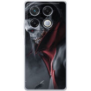Чехол BoxFace Infinix GT 20 Pro 