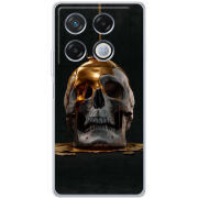 Чехол BoxFace Infinix GT 20 Pro 