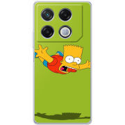 Чехол BoxFace Infinix GT 20 Pro 