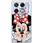 Прозрачный чехол BoxFace Infinix GT 20 Pro Lady M