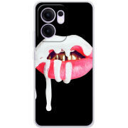 Чохол BoxFace OPPO Reno 13 FS 5G 