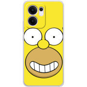 Чохол BoxFace OPPO Reno 13 FS 5G 