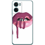 Чохол BoxFace Motorola G05 