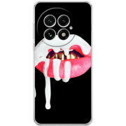 Чохол BoxFace OnePlus 13 