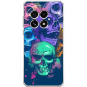 Чохол BoxFace OnePlus 13 