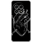 Чохол BoxFace OnePlus 13 