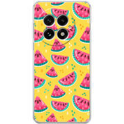Чохол BoxFace OnePlus 13 