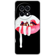 Чохол BoxFace OnePlus 13R 