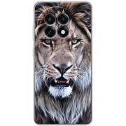 Чохол BoxFace OnePlus 13R 