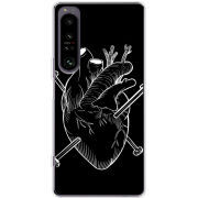 Чохол BoxFace Sony Xperia 1 IV 