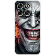 Чохол BoxFace Nubia V70 Prankster