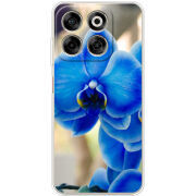 Чохол BoxFace Nubia V70 