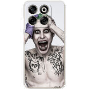 Чохол BoxFace Nubia V70 