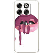 Чохол BoxFace Nubia V70 