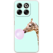 Чохол BoxFace Nubia V70 