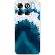 Чохол BoxFace Nubia V70 