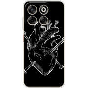 Чохол BoxFace Nubia V70 