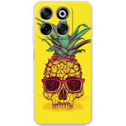 Чохол BoxFace Nubia V70 Pineapple Skull