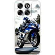 Чохол BoxFace Nubia V70 