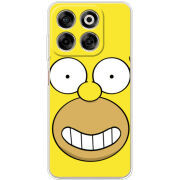 Чохол BoxFace Nubia V70 