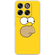 Чохол BoxFace Nubia V70 