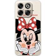 Прозорий чохол BoxFace Nubia V70 Lady M