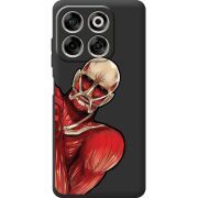 Чорний чохол BoxFace Nubia V70 Титан