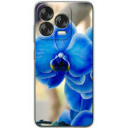 Чохол BoxFace Nubia V70 Design 