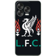 Чохол BoxFace Nubia V70 Design L. F. C.