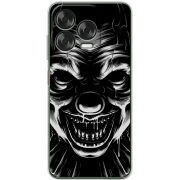 Чохол BoxFace Nubia V70 Design 