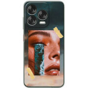 Чохол BoxFace Nubia V70 Design 