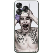 Чохол BoxFace Nubia V70 Design 