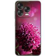 Чохол BoxFace Nubia V70 Design 