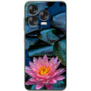 Чохол BoxFace Nubia V70 Design 