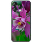 Чохол BoxFace Nubia V70 Design 