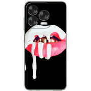 Чохол BoxFace Nubia V70 Design 