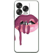 Чохол BoxFace Nubia V70 Design 