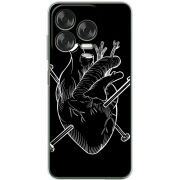 Чохол BoxFace Nubia V70 Design 