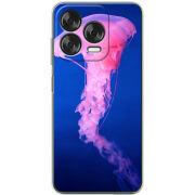 Чохол BoxFace Nubia V70 Design 