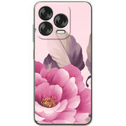 Чохол BoxFace Nubia V70 Design 